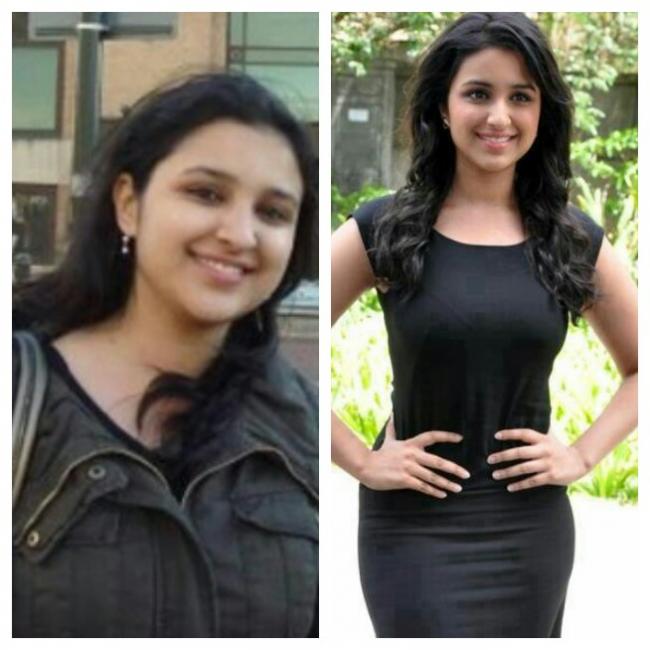 Before After Weight Loss Celebrity